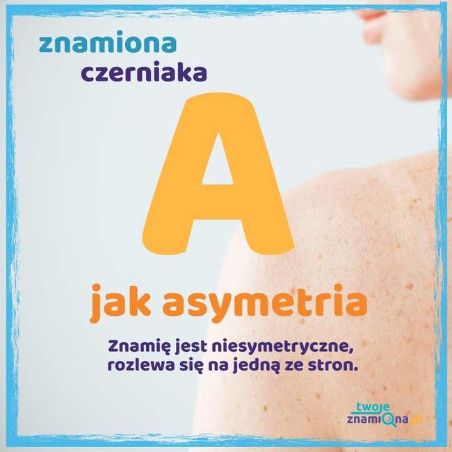 Asymetria
