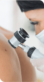 Jak często powinno się badać znamiona za pomocą dermatoskopu?