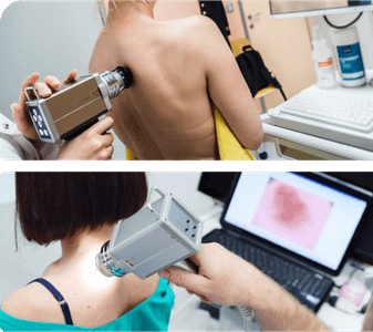 Wideodermatoskopia zmian skórnych Wideodermatoskopia zmian skórnych