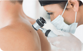 Jak często powinno się badać znamiona za pomocą dermatoskopu?