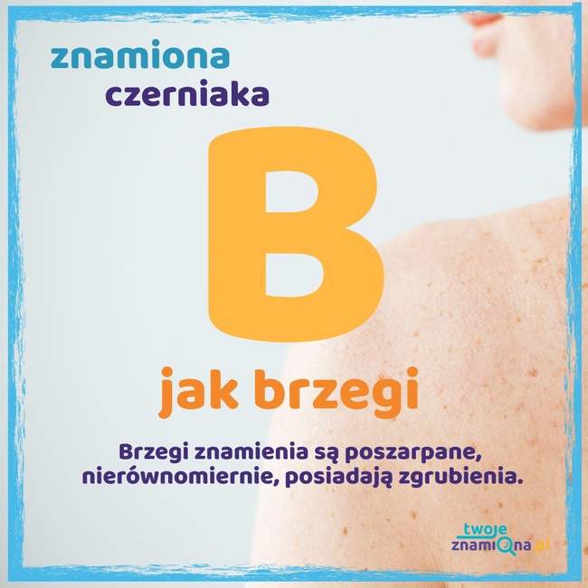 Brzegi