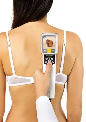 Wideodermatoskop Mikroderm D200 Evo firmy Bechtold - urządzenie do komputerowego badania znamion zmienne powiększenie kamera HD